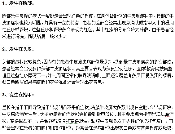 牛皮癬疾病常見的發(fā)病部位有哪些？