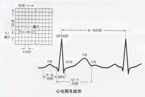 心電圖各波簡(jiǎn)介