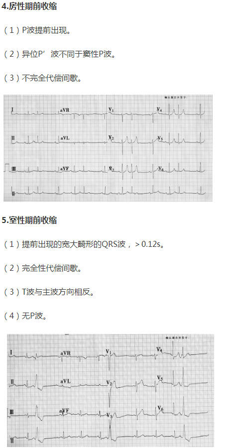 房型前期收縮